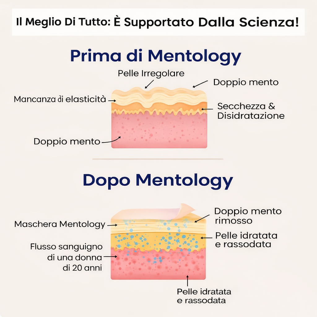 Mentology™ Lift - Offerta Saldi Invernali 2026